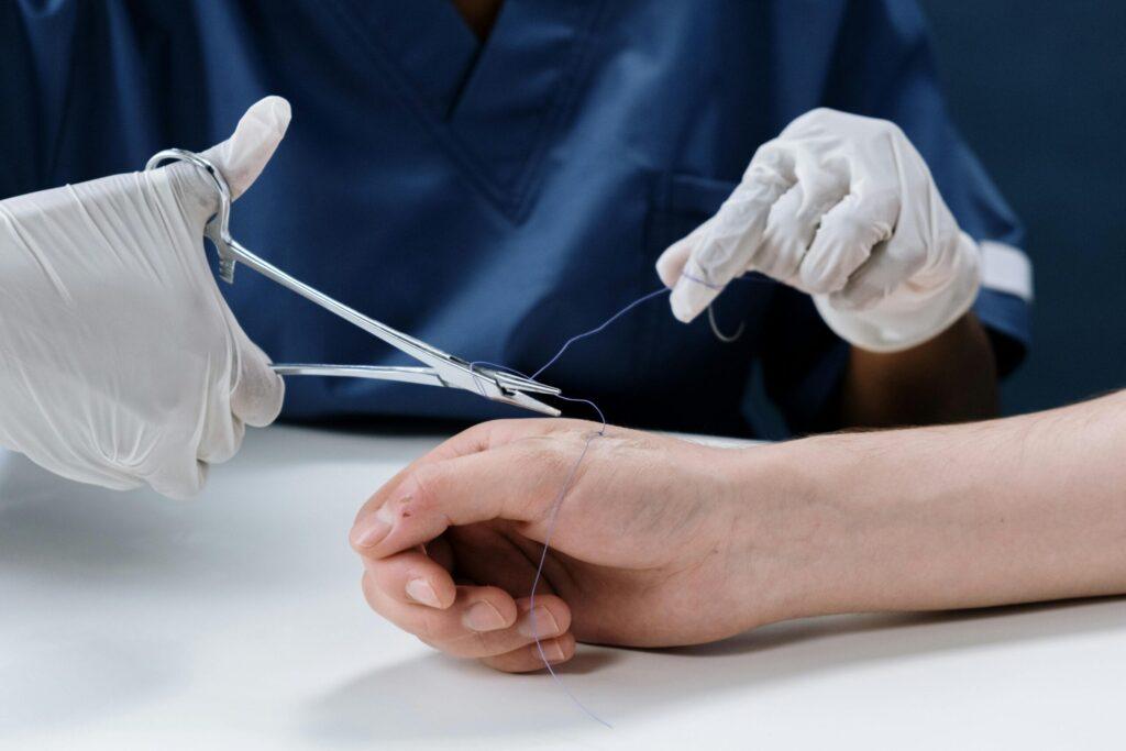 A healthcare professional carefully suturing a hand, showcasing precision in suture techniques.
