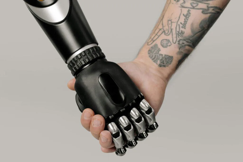 the-mangled-limb-prosthetic-arm-post-surgery Tattooed human hand holding a prosthetic hand in a studio setting, symbolizing connection and technology. a patient with mangled limb who undergoes amputation and applied prosthetic arm post surgery