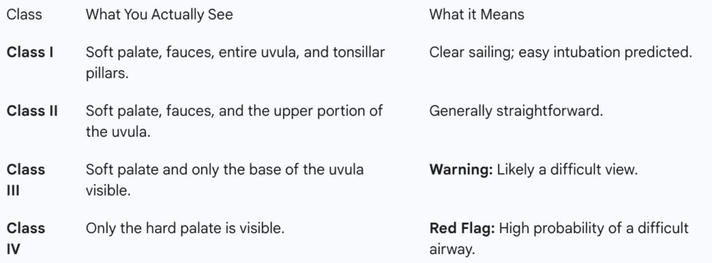 A comparison table of Modified Mallampati Classes I-IV, detailing visible structures from the soft palate to the hard palate and their clinical difficulty.